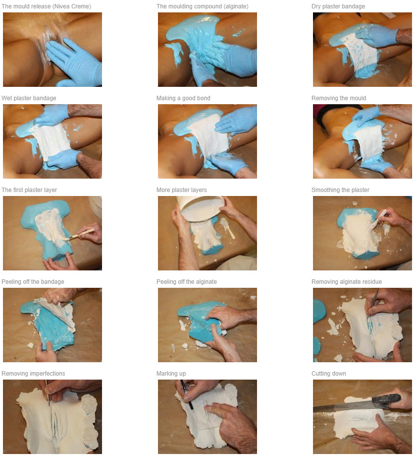 Этап нанесения формовочной массы на интимную зону