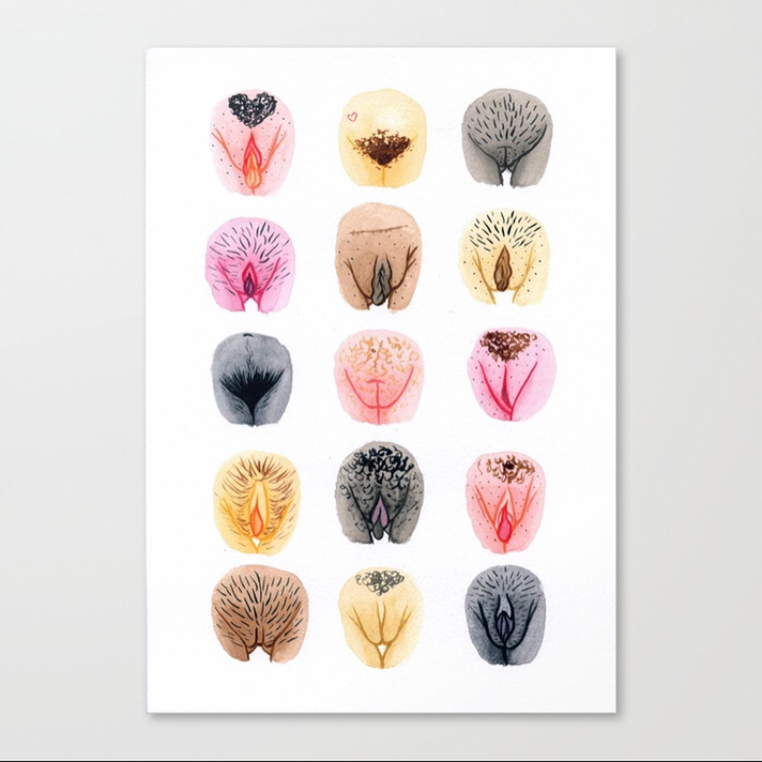 Иллюстрация разнообразия форм малых и больших половых губ