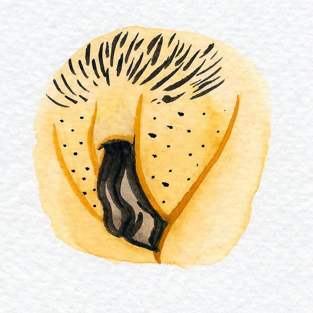 Изображение вульвы с темной пигментацией