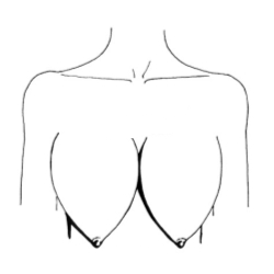 Объемная округлая форма груди Арбузы