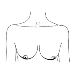 Мягкая форма груди Блины