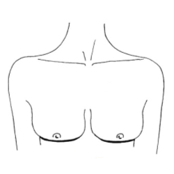 Широкая, плоская форма груди Блюдца