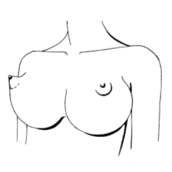 Коническая форма груди Чайнички