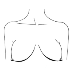 Форма груди Лимоны: небольшая, симметричная и упругая