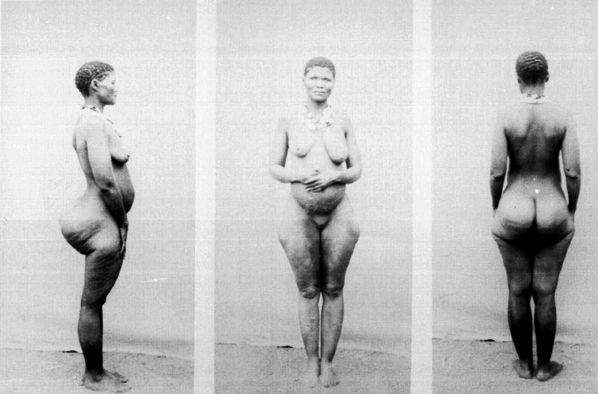 Особенности строения тела, фото 3