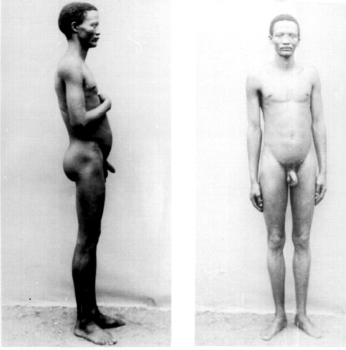 Антропология Южной Африки, фото 7