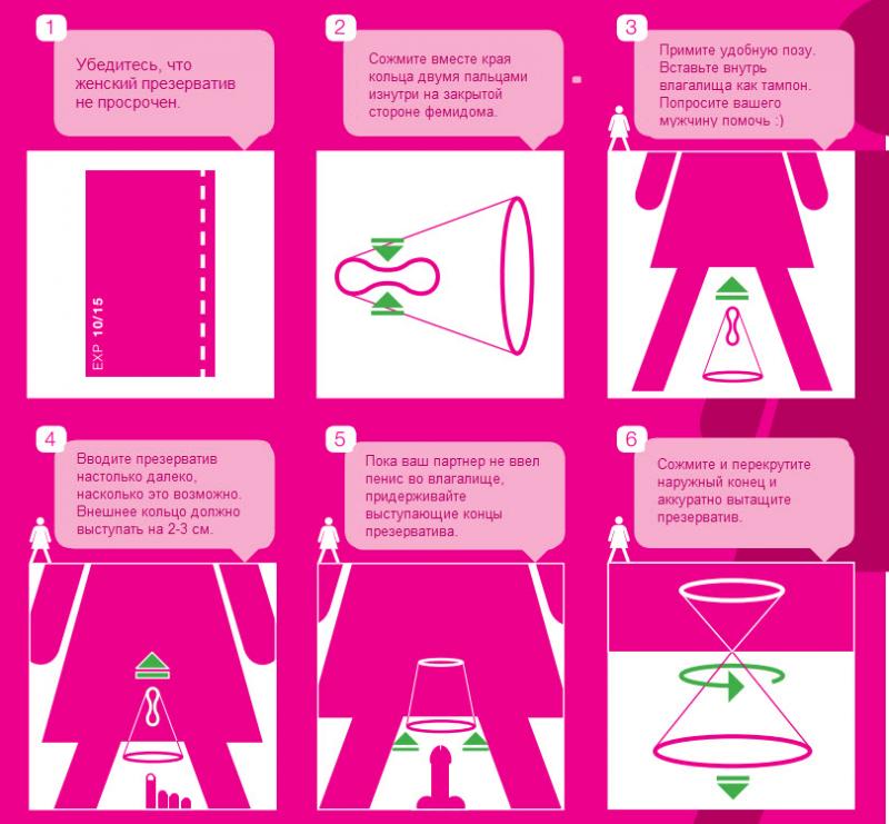 Пошаговая инфографика введения фемидома во влагалище