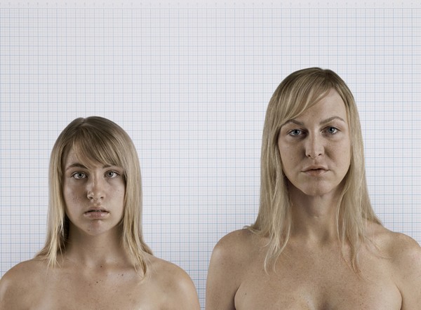 Взросление транссексуалов выставили в музее